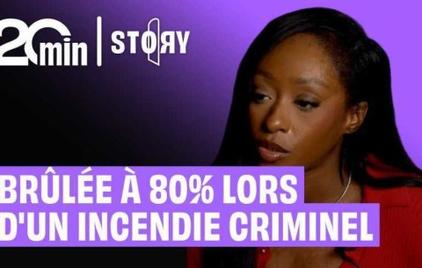 20 Minutes Story : « Brûlée à 80 % lors d'un incendie criminel », une femme en pull rouge devant un fond violet